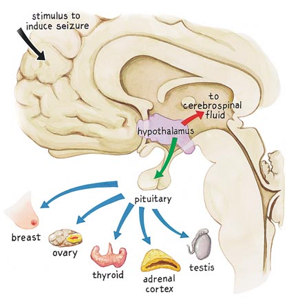 Shocking the Brain: The Wild History of Electroconvulsive Therapy