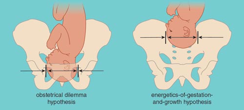 The obstetrical dilemma hypothesis postulates that newborn brain size is limited by the disadvantages to the mother’s locomotion posed by wider hips. The energetics-of-gestation-and-growth hypothesis postulates that the baby’s head size is limited by the metabolic cost to the mother of carrying a large baby. <strong>Illustration by Tom Dunne.</strong>
