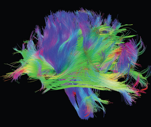 A wiring map of the human brain shows connections within the white matter, coded by color (red is left-right; green is anterior-posterior; blue is ascending-descending). Learning how a brain makes a mind is one of the great adventures of our era. <strong>Image courtesy of the Laboratory of Neuro Imaging and Martinos Center for Biomedical Imaging, Consortium of the Human Connectome Project, www.humanconnectomeproject.org.</strong>