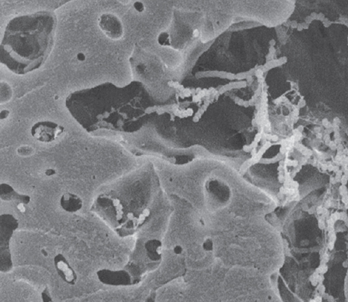 A scanning electron microscope reveals bacteria at work in the casein matrix in a mozzarella starter culture. <strong>From <em>The Science of Cheese</em>.</strong>
