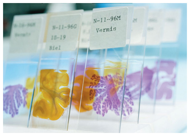 Brain tissue from a long-term aging study of nuns provides clues on the origin of Alzheimer’s disease. The study was conducted in part at the Aging Center, University of Kentucky. <strong>Karen Kasmauski/Corbis.</strong>